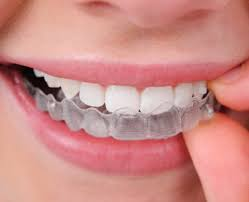 How to Access Invisalign Doctor Login